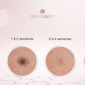 photographie extraite du film publicitaire Cryo Beauté