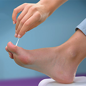 photographie extraite du film publicitaire Excilor Acid Wart