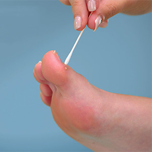 photographie extraite du film publicitaire Excilor Acid Wart