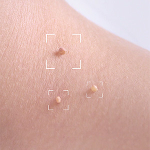 photographie extraite du film publicitaire Excilor Skintag